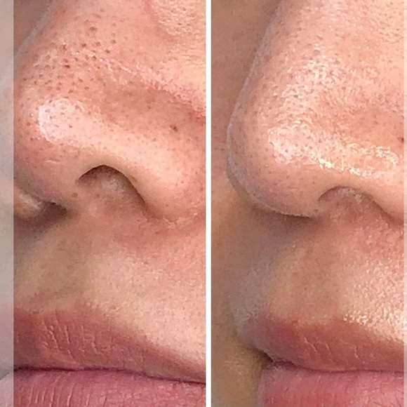 ACEOLOGY-DETOXIFYING TREATMENT MASK - Picture 5 of 6